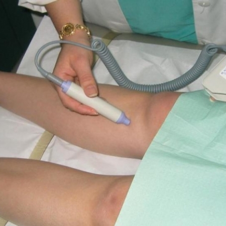 Kolor Dopler krvnih sudova ruku i nogu